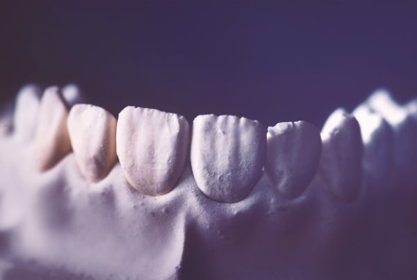 prótese-dentária